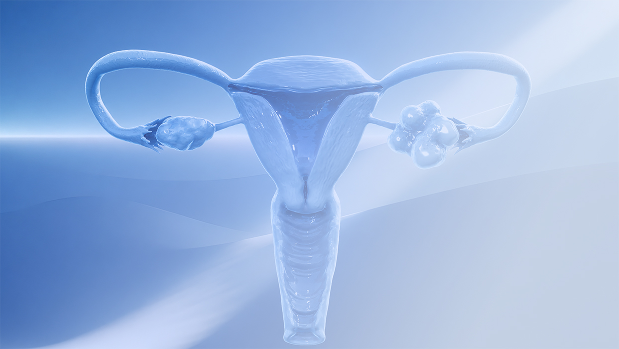 PMOS State of the Art: metabolische und reproduktive Gesundheit sowie Hyperandrogenismus